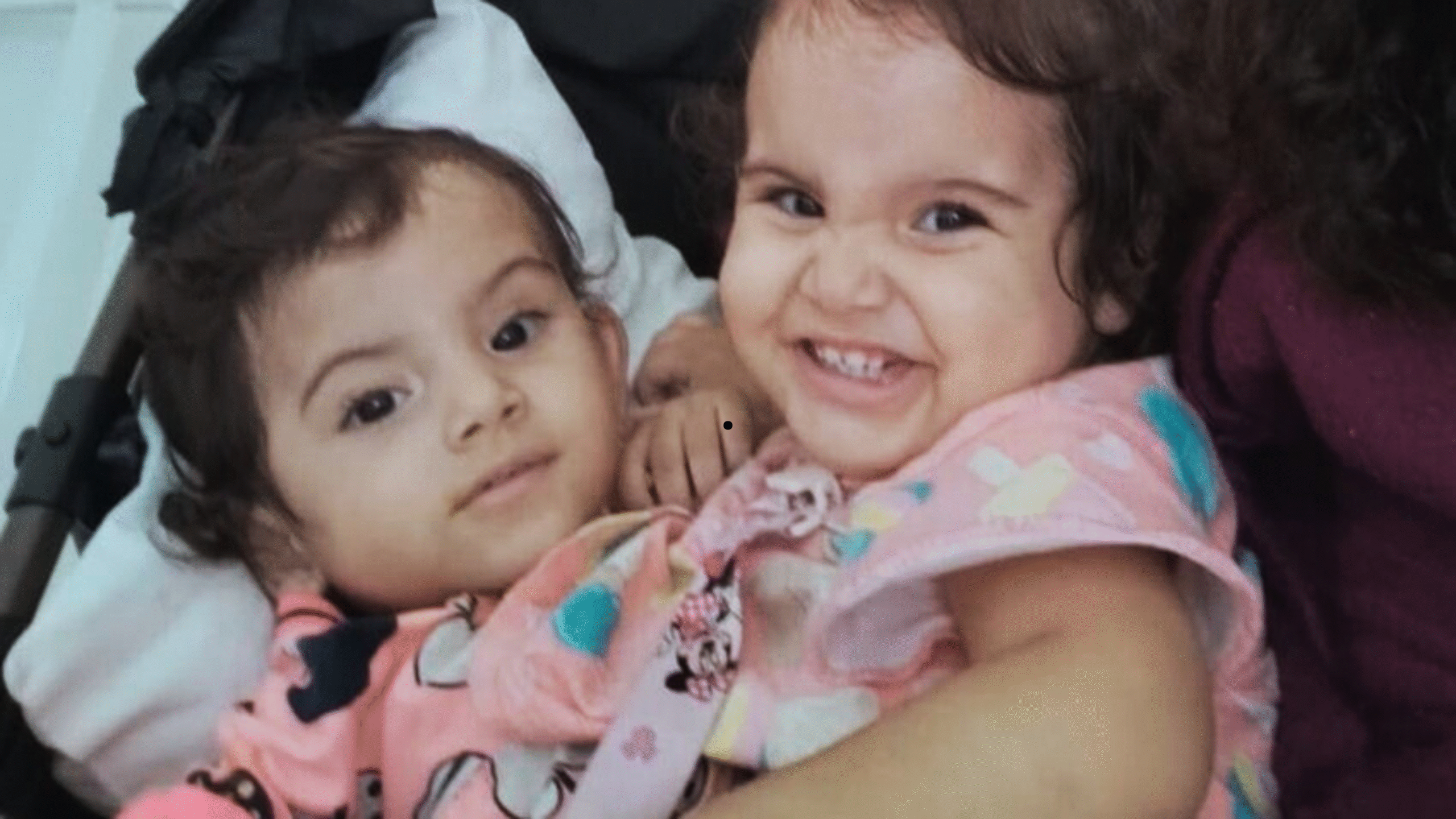 Gêmeas siamesas Kiras e aruna