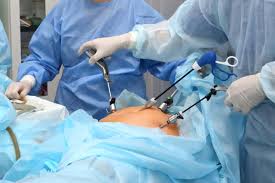 Cirurgia bariátrica gratuita no Tocantins já realizou mais de 260 procedimentos e pode beneficiar pacientes com obesidade grave Tocantins 