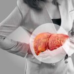Gordura no fígado: alimentos que ajudam a prevenir o problema. 17 Gordura no fígado